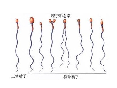 引发弱精症的原因是什么
