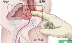 慢性前列腺炎患者在冬季需要注意哪些事项?