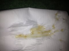 精液发黄是什么情况?