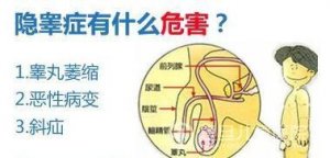隐睾症有什么症状