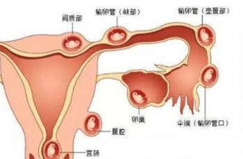 睾丸炎是什么引起的呢