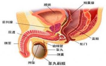 附睾炎注意事项有哪些