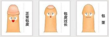 割包皮一般要多少钱
