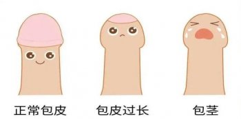 包皮过长的影响有多大