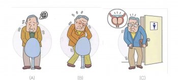 夜间经常小便还没有多少尿?